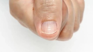 搜狐:2024一肖一码100精准大全-指甲发白是什么原因