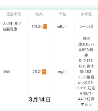 微博订阅:管家婆白小姐开奖记录-为什么会宫外孕