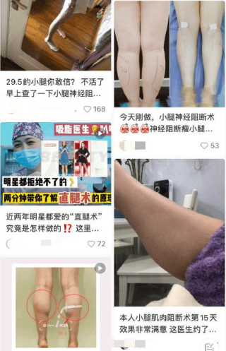 小红书:新澳彩资料免费资料大全客家娘-小腿酸胀痛是什么原因