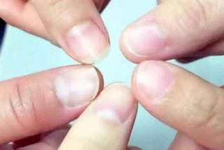 搜狐:2024一肖一码100精准大全-指甲发白是什么原因