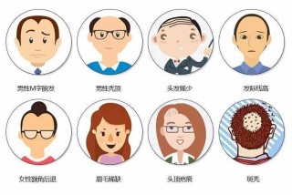 小红书:新奥资料免费精准-明星哪个秃顶