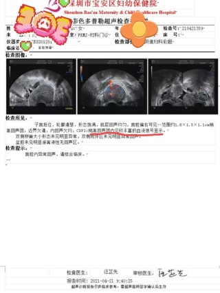 知乎：白小姐三期必出一肖中特-稽留流产什么意思