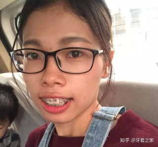 微博订阅:新澳资料免费精准-龅牙怎么拍照