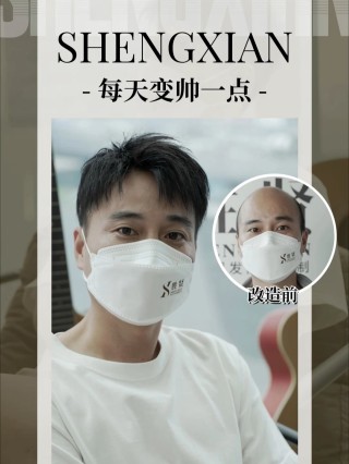 小红书:新奥资料免费精准-明星哪个秃顶