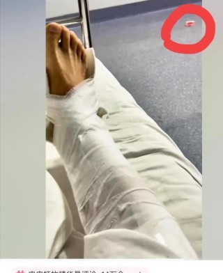 百度平台:白小姐一肖一码100正确-骨折一个月能恢复到什么程度