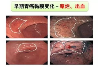 微博订阅：欧洲杯下单平台(官方)手机APP下载IOS/安卓/网页通用版入口-病理活检是什么意思