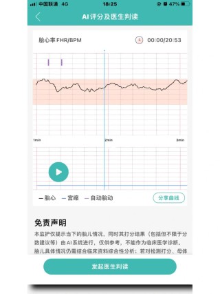 搜狗订阅:香港一肖一码100%中-胎监是检查什么的