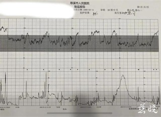 搜狗订阅:香港一肖一码100%中-胎监是检查什么的