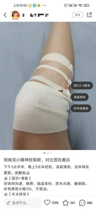 小红书:新澳彩资料免费资料大全客家娘-小腿酸胀痛是什么原因