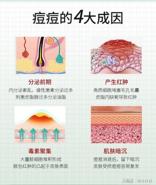 微博:澳门免费公开资料大全-长痘痘涂什么药膏