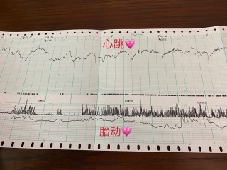 搜狗订阅:香港一肖一码100%中-胎监是检查什么的