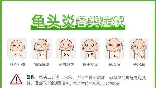 腾讯：2024年澳门一肖一码期期准-水晶绒是什么面料  第2张
