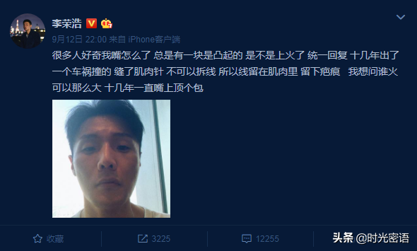 微博订阅：欧洲杯下单平台(官方)手机APP下载IOS/安卓/网页通用版入口-减张缝合是什么意思  第1张