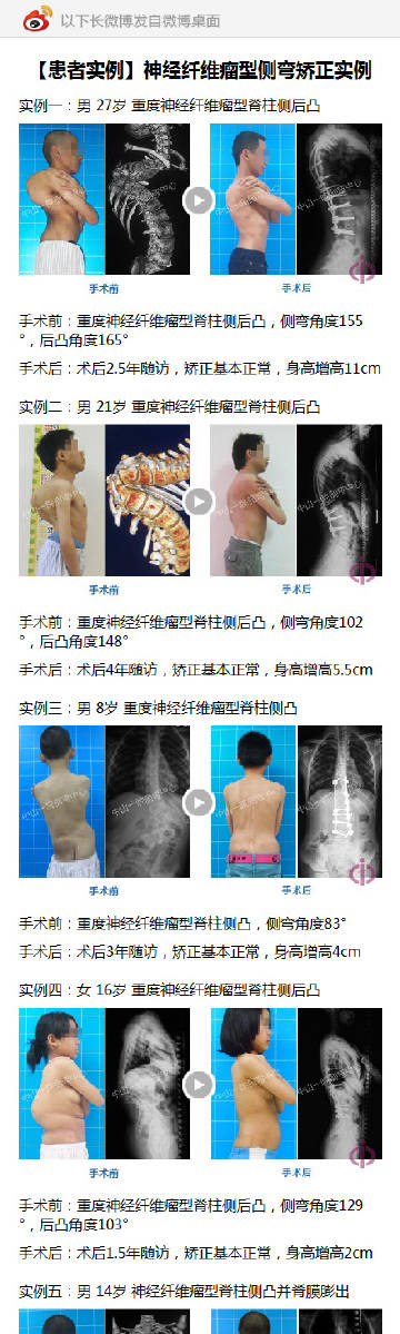 腾讯：新奥彩2024年免费资料查询-颈椎反弓是什么  第1张