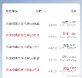 网易:澳门一肖一码100%精准-抗sm抗体阳性什么意思  第2张