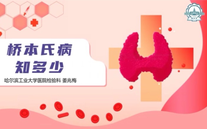 微博订阅:澳门码资料版本大全-桥本病是什么病  第3张