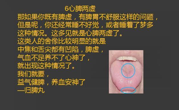腾讯：澳门正版资料大全免费六肖-脾虚气滞吃什么中成药  第3张