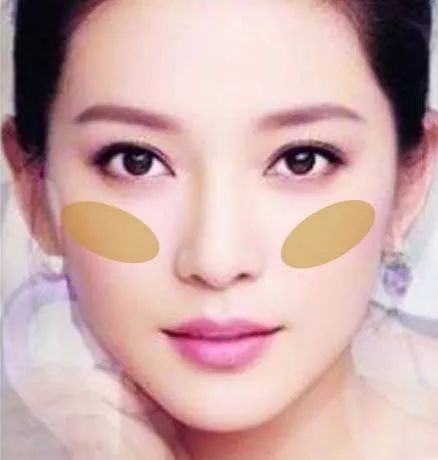 搜狐订阅：2024新澳门正版免费资料-颧骨两边长斑是什么原因  第3张