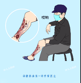 搜狗订阅:香港期期准资料大全-静脉炎的症状是什么  第2张