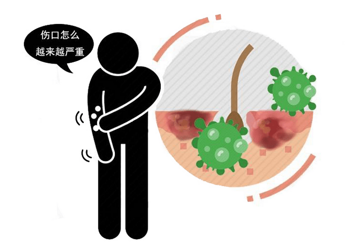搜狗订阅:香港期期准资料大全-静脉炎的症状是什么  第3张