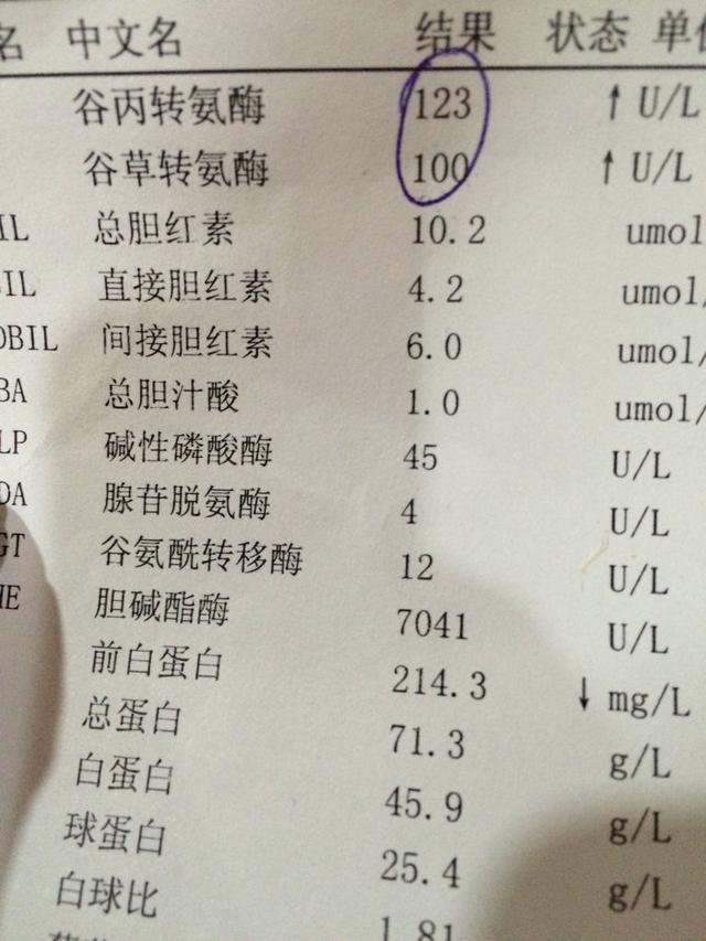 百度平台:949494澳门网站资料免费查询-转氨酶高是怎么回事有什么危害  第2张