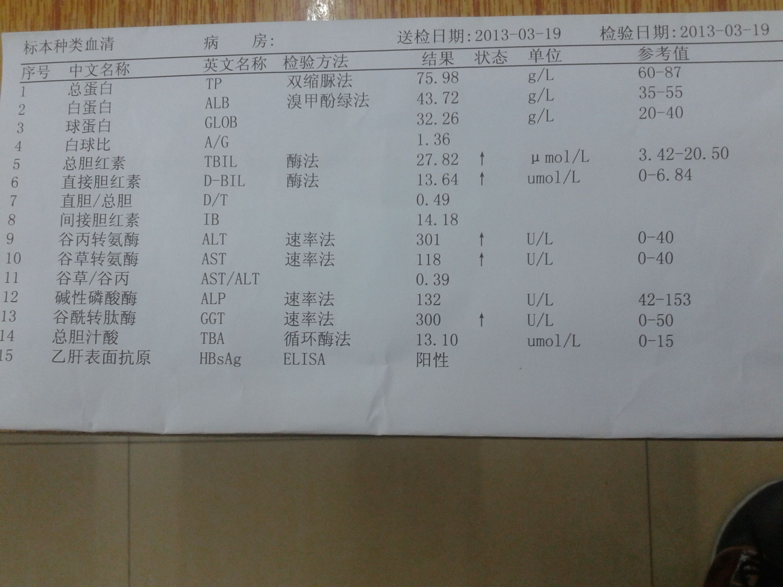 中新网:4949澳门开奖结果-转氨酶高有什么症状  第2张