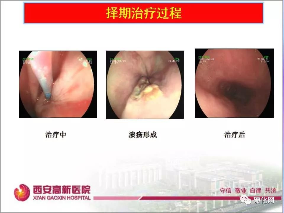百家号:澳门一码中精准一码免费中特-静脉曲张看什么科  第2张