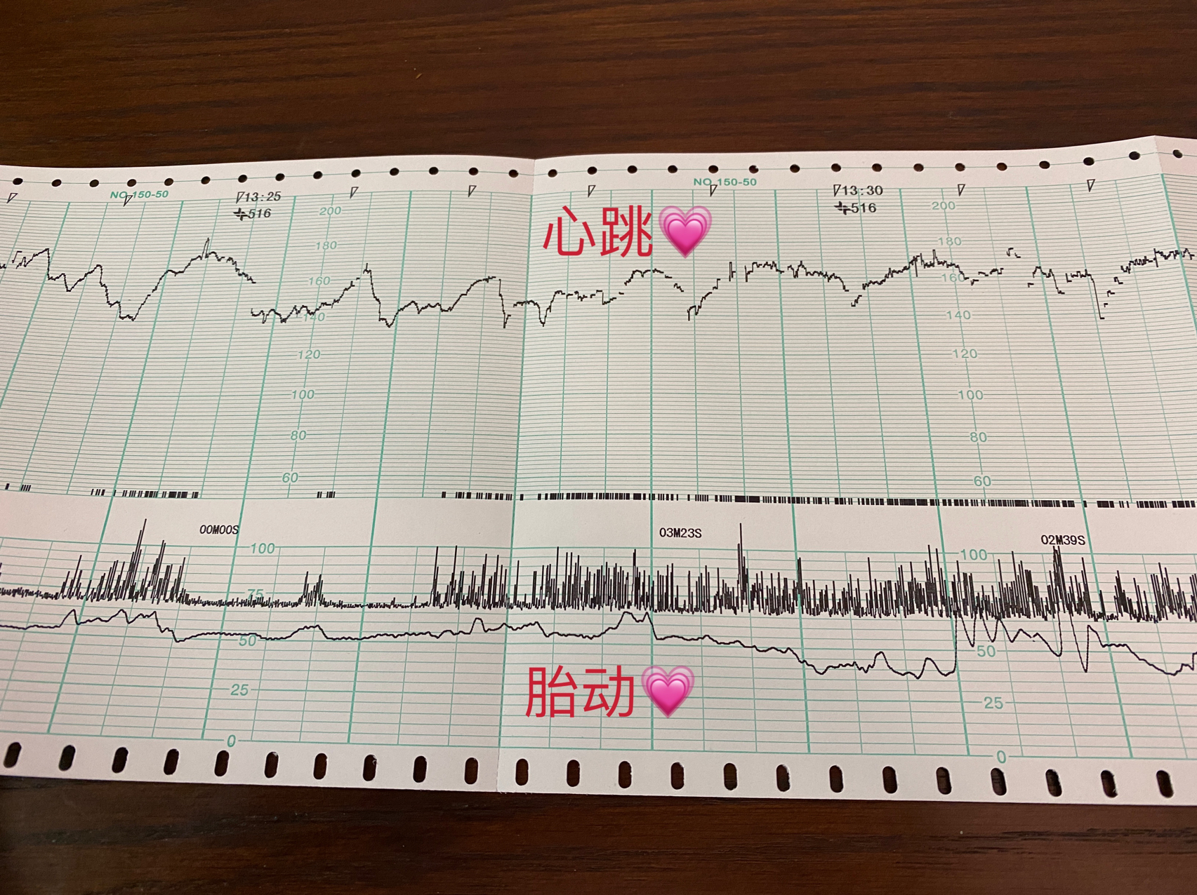 搜狗订阅:香港一肖一码100%中-胎监是检查什么的  第2张