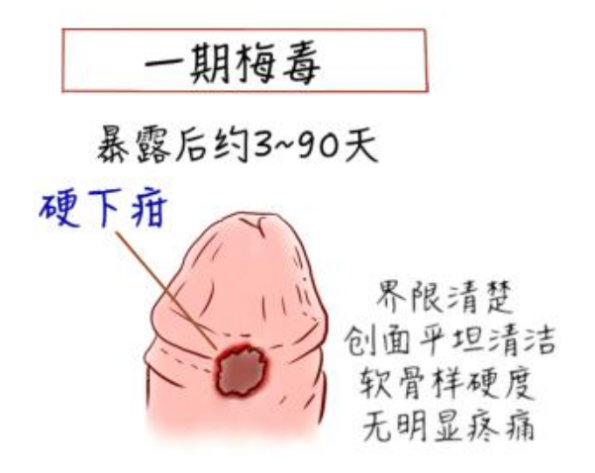 中新网:2024管家婆正版六肖料-硬下疳是什么  第1张