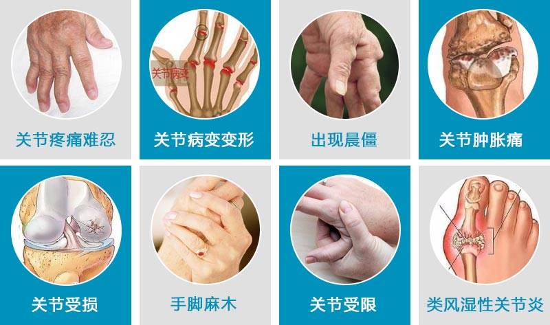 搜狐订阅：澳门三期必内必中一期-类风湿性关节炎的症状是什么  第3张