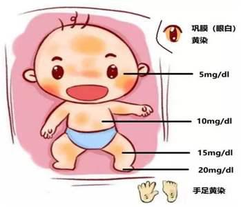 百家号:香港一肖一码公开免费资料-新生儿为什么会有黄疸  第3张
