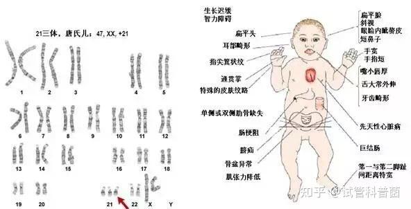 微博订阅:澳门资料免费大全-21三体综合症是什么  第2张
