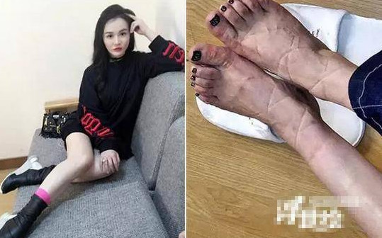 网易:新澳高手论坛资料大全最新-哪个女明星的脚最丑  第1张