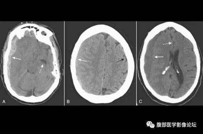 小红书:新澳门4949免费资料大全-硬膜囊受压是什么意思  第2张