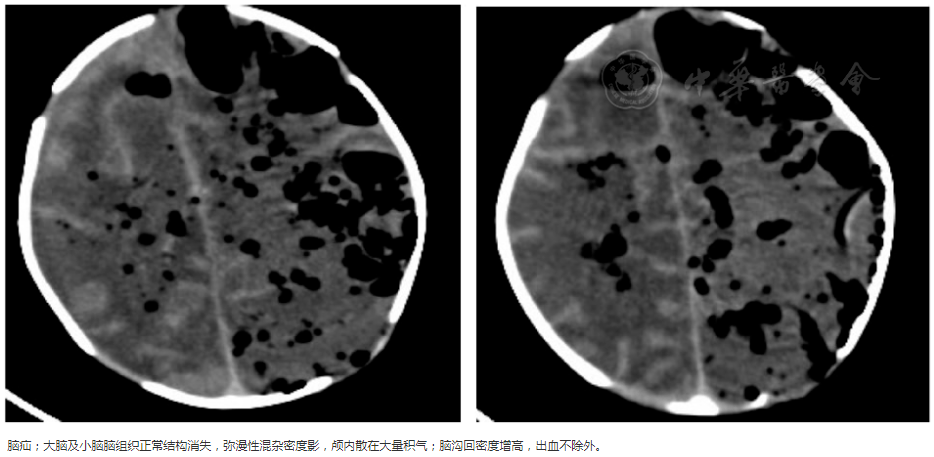 小红书:新澳门4949免费资料大全-硬膜囊受压是什么意思  第3张