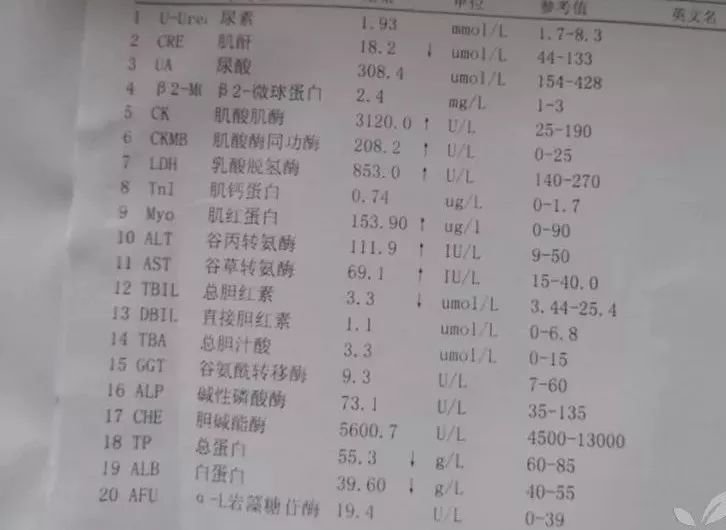 阿里巴巴:澳门一码一肖一特一中2024年-心肌酶高是什么原因  第1张