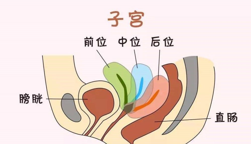 知乎：香港4777777最快开码-子宫后倾位是什么意思  第2张