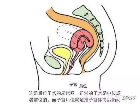 知乎：香港4777777最快开码-子宫后倾位是什么意思  第3张
