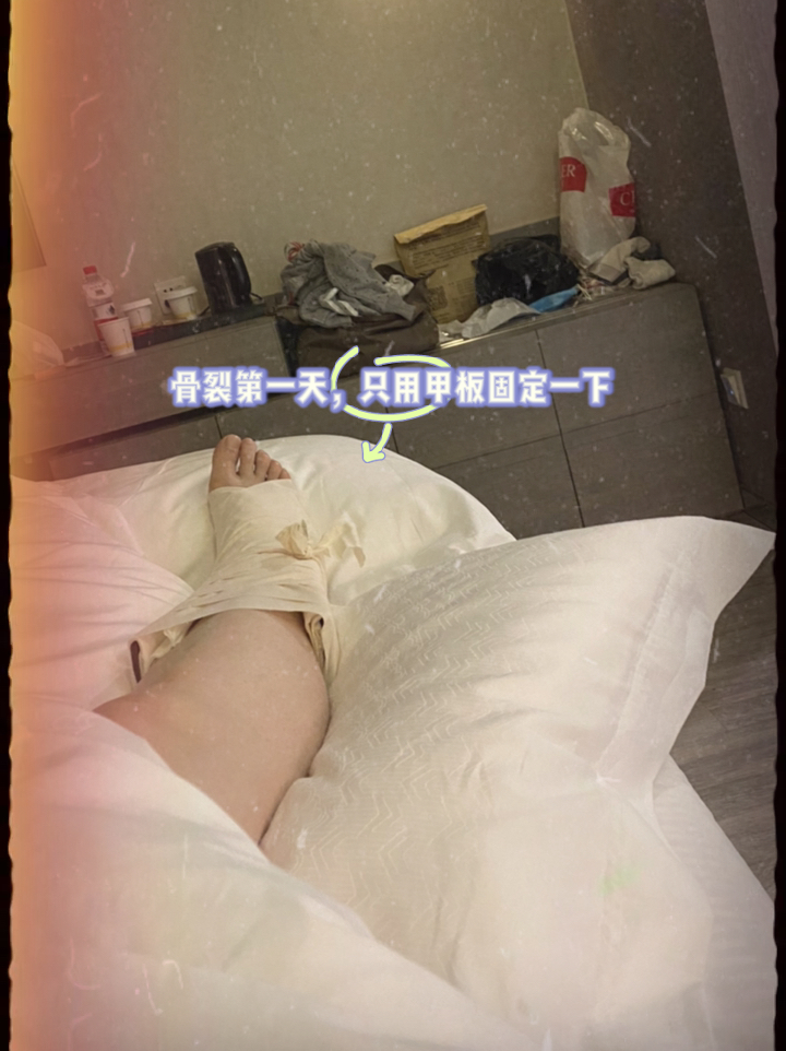 百度平台:白小姐一肖一码100正确-骨折一个月能恢复到什么程度  第3张